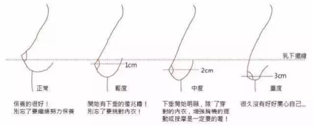 可以用剪刀剪掉,但不能用剃刀或镊子 有些女性会发现乳头旁有少量