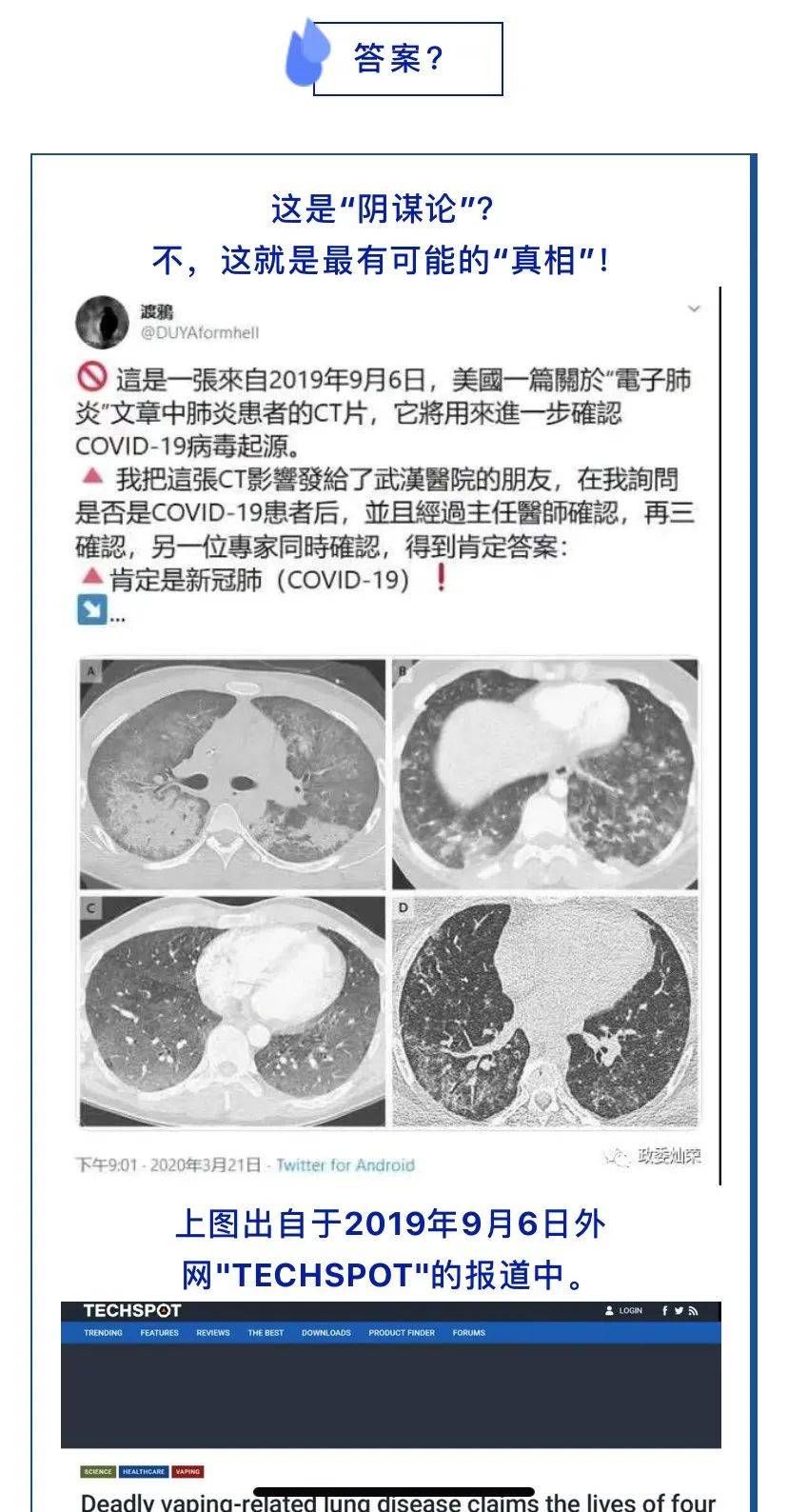 美国媒体追查到疑似新冠肺炎零号病例，特朗普请你解释一下