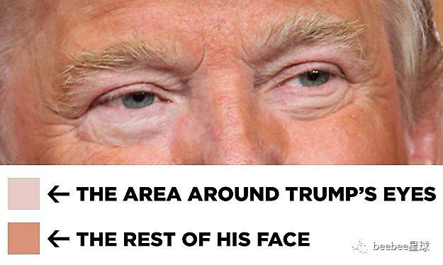 为什么特朗普的眼袋是白色的？